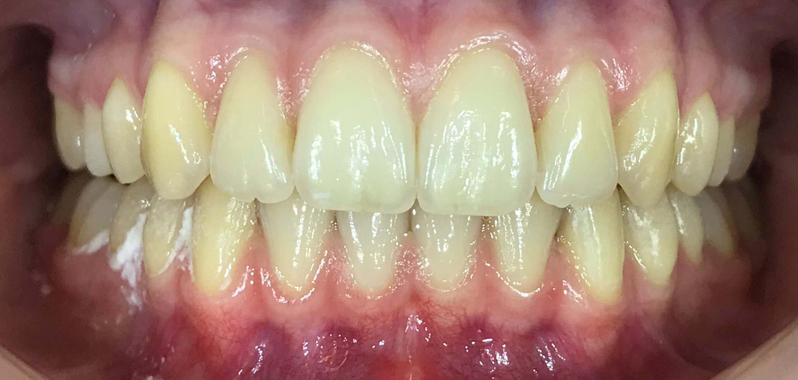 1.1a-scaled.jpg 1.1a-scaled.jpg